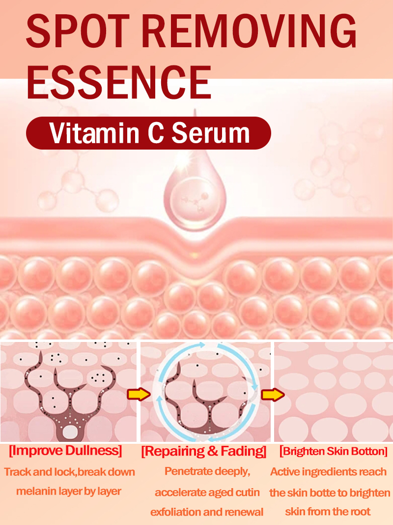 Ilumina las pecas Melasma, las - Ultra Luxury Skincare reseña y precio
